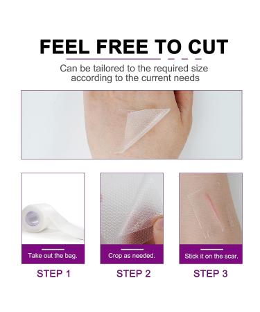 Joyeee Silicone Scar Tape Roll for Professional Scar Removal - Reusable Self Adhesive Silicone Strips for C-Section Surgery, Burn, Keloid, Acne - 1.6 x 60 - Buy Online on GoSupps.com
