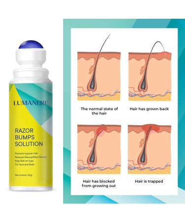 Lumanere Razor Bumps Solution + Hair Inhibitor After Shave Serum | Roll-on for Bikini, Legs, and Underarms - Men and Women - Buy Online on GoSupps.com