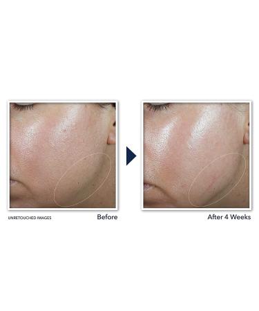 RoC Derm Correxion Neck Cream with Hyaluronic Acid and Retinol - Tighten & Lift Neck Lines - 1.7oz - Buy Online on GoSupps.com