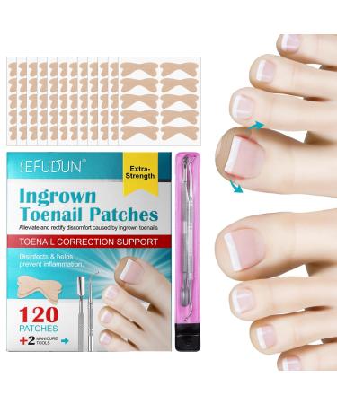 Toenail correction paving 120 pieces correction for ingrown toenails |Nail correction paving for relief in an ingrown toenails at home suitable for all nail sizes Rasoli