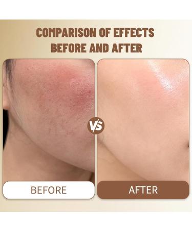 phoebel New Beef Tallow for Skin - Natural Tallow and Honey Balm Face Moisturizer Hydrating for Dry Skin - Citrus - Buy Online on GoSupps.com