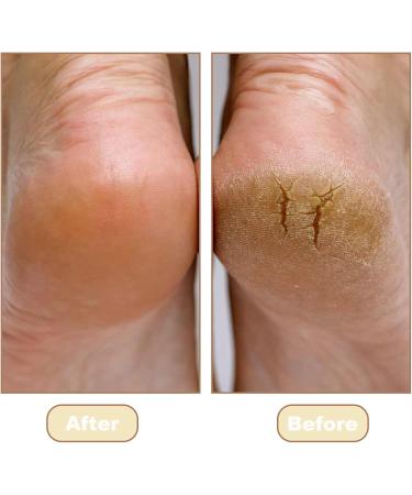 QSZHSL Pack of 4 pairs of moisturizing gel heel socks - Open heel socks - Foot protection - S - Buy Online on GoSupps.com