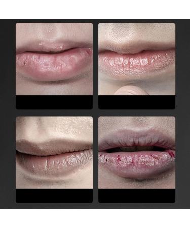 Moisturizing Nourishing Lip Balm for Men - Repair Dry Cracked Lips 3.3g | International Shipping - Buy Online on GoSupps.com