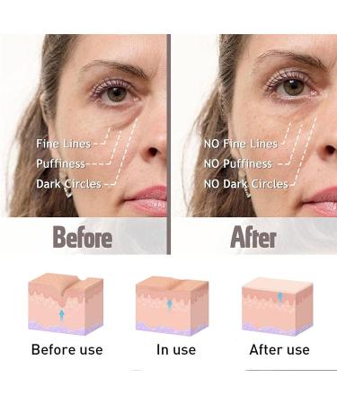 Verfons Snake Venom Firming Eye Cream 2PCS - Anti Aging Eye Bag Cream for Instant Results - Buy Online on GoSupps.com
