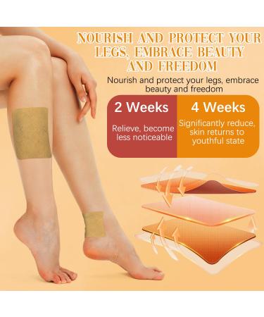 Wanban 48 PCS Turmeric Varicose Vein Patch Natural Relief Treatment for Legs Spider Varicose Vein Patch - Buy Online on GoSupps.com