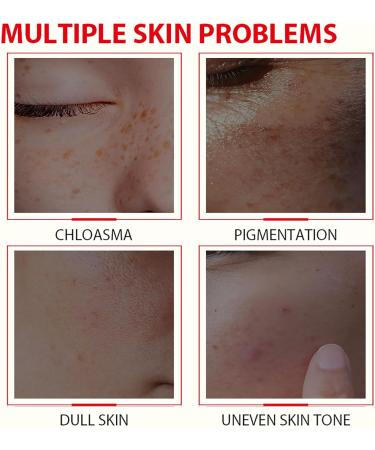 Glutathione Serum - Kojic Acid Serum for Skin Lig_htening - Dark Spot Correcting Glow Serum - Vitamin C Serum for Face - Hydrating Serum - Facial Serum for Even Skin Tone Moisturising (30ml) - Buy Online on GoSupps.com