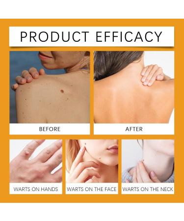  ALLILUYAA Pack of 2 Lipogo Bee Venom creams - Buy Online on GoSupps.com