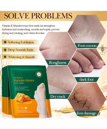 6 Paires de Chaussettes Masques Pieds la Vitamine E et au Miel Soin Nourrissant et R parateur Intense pour Pieds Secs et Gerc s Adoucit les Talons Fendill s Effet Protecteur et Apaisant - Buy Online on GoSupps.com
