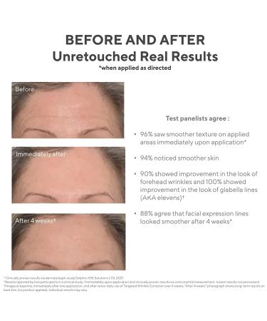 Murad Resurgence Targeted Wrinkle Corrector - Hyaluronic Acid Anti-Aging Cream - 0.5 Fl Oz - Buy Online on GoSupps.com