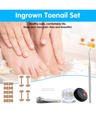 Jeffdad Ingrown Toenail Treatment Kit | Professional Removal & Correction | Lifter & Clipper Included | Quick & Effective Nail Repair - Buy Online on GoSupps.com