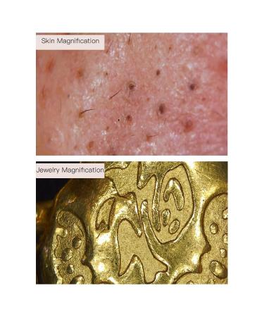 100X Magnification Skin Hair Scalp Detector | 2MP Camera Skin Health Analyser for Home & Salon Use - Buy Online on GoSupps.com