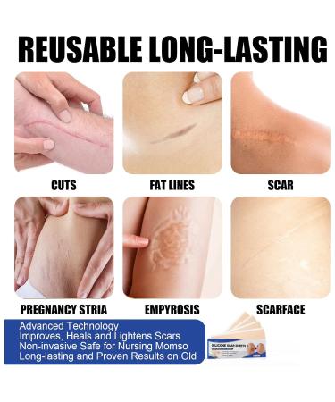 Silicone Gel Scar Patch - Fade Stretch Marks, Burns & Cuts, Smooth Skin - Tinted Face Moisturizer - One Size - Buy Online on GoSupps.com