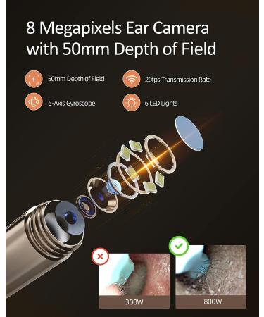 BEBIRD M9 Pro Ear Wax Removal Tool with 6 LED Lights | 1080P Ear Camera and Ear Cleaner for Adults and Kids - Green - Buy Online on GoSupps.com