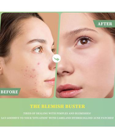 Buy ZONTO Essential Oil Acne Patch - Fast International Shipping for Clear Skin - Buy Online on GoSupps.com