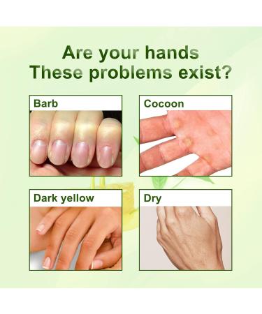 Hands Moisturizing Mask - Ultimate Hand Care for Whitening & Dry Skin Relief | Hydrating Skin Care Treatment - Buy Online on GoSupps.com