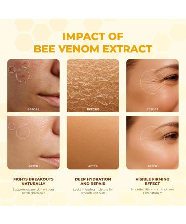 Bee Venom Cream | Hydrating Smoothing Firming Wrinkle-Reducing | Comprehensive Bee Venom Skin Treatment Cream (Enhanced Formula) - Buy Online on GoSupps.com