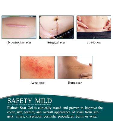 Professional Silicone Scar Sheets for C-Section, Surgery, Burn, Keloid, Acne | 3Meters Roll - Drug-Free Solution - Buy Online on GoSupps.com