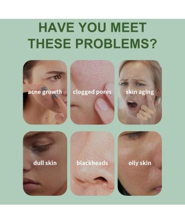 Cucumber Bubble Clay Face Mask Clay Mask for Pores Green Tea Mud Mask Deep Cleansing Face Mask Controlling Oil Acne & Refining Pores Reduce Blackheads & Dark Spots Elastic & Smooth Skin - Buy Online on GoSupps.com