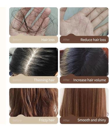  Filvczt Hair growth oil hair volumizing oil scalp care with increased volume reduces split ends and breakage 100 ml for men and women hair types - Buy Online on GoSupps.com