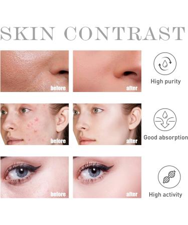 Salicylic Acid Serum 30ml - Face Exfoliator - Hyaluronic Acid Serum - Skincare Face Oil - Dark Spot Correcting Glow Serum - BHA Exfoliant - Hydrating Serum for Face Peeling Moisturising and Soothing - Buy Online on GoSupps.com