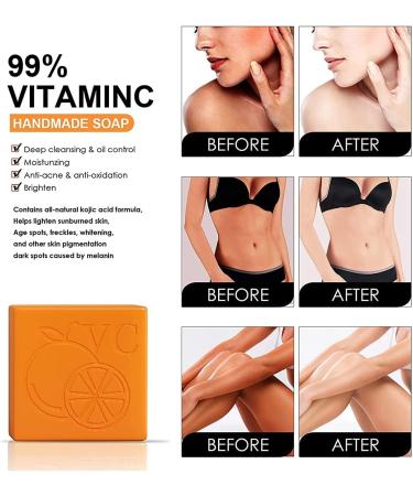 Lovelycat Savon la vitamine C l'orange douce pour les soins exfoliants et hydratants du visage et du corps savon blanchissant artisanal genou fonc (2PC) - Buy Online on GoSupps.com