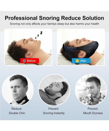 Anti Snoring Chin Strap for CPAP Users | Snore Reduction Solution | Comfortable & Skin-Friendly Elastic Compression Device - Buy Online on GoSupps.com