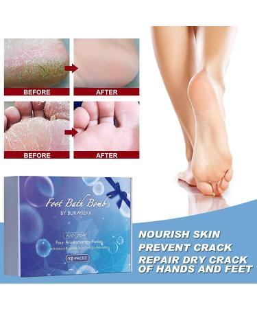 Tea Tree Oil & Ginger Foot Bath Bombs - Moisturizing Soak for Dry Skin, Relaxing Scents, Foot Odor & Toenail Fungus Relief - Buy Online on GoSupps.com
