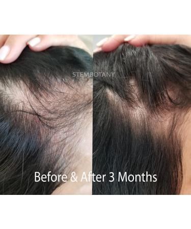 GHK-cu Copper Peptide Hair Regrowth Shampoo for Men & Women - Boost Hair Growth Nourish & Revitalize Shop Internationally - Buy Online on GoSupps.com