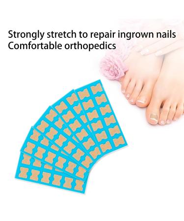 Fitmedify Toenail Correction Patch - 60 Pcs for Ingrown Toenail Prevention - Buy Online on GoSupps.com