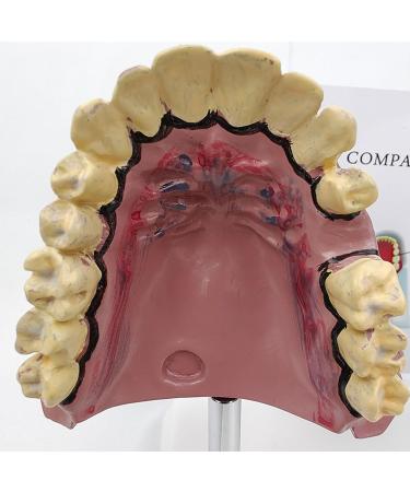 Upikit Dental Model for Sick Teeth - Compare Smoking vs Normal Teeth | Ideal for Medical Demonstrations - Buy Online on GoSupps.com