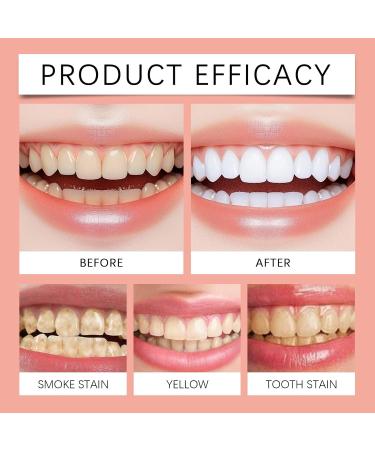 KLYso Freshness Boost Toothpaste - Gentle Cleaning & Whitening for Daily Oral Care Promote A Refreshing Mouth Environment(2PCS) - Buy Online on GoSupps.com