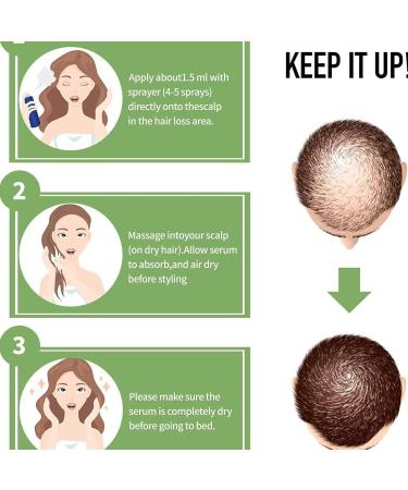 fanelod Hair Growth for Women - Natural Ginger Hair Growth Serums 20ML Biotin Hair Growth - Nourishing Ginger - Buy Online on GoSupps.com
