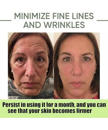 Avocado Face Serum Avocado Anti Wrinkle Face Serum & Oils Smooth Fine Lines & Anti Aging - Buy Online on GoSupps.com