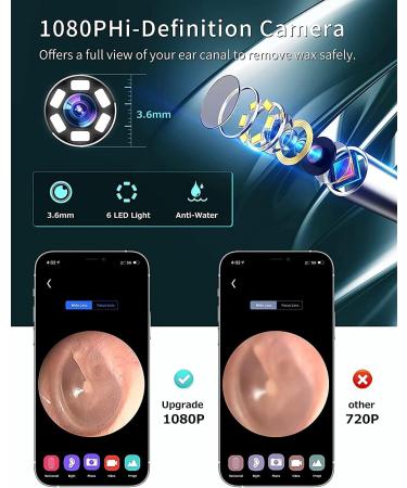 1080P FHD Wireless Otoscope Ear Wax Removal Cleaner | IP67 Waterproof | 6 LED Lights | Portable Gray Kit - Buy Online on GoSupps.com