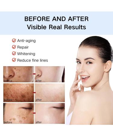 Tongyend Dark Spot Correcting Glow Serum Facial Serum Brightening Essence Dark Spot Correcting Glow Serum Brightening Serum Skin Lightening Cream for Dark Skin Collagen Boost Anti Aging Aerum - Buy Online on GoSupps.com
