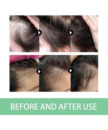 Rosemary Hair Growth Conditioner 100ML Rosemary Strengthening Conditioner for Hair Care Moisturize & Soften Hair Locks In Moisture to Soft Hair & Nourish Scalp (2) - Buy Online on GoSupps.com