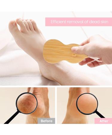 Callus Remover Nano Glass Callus Removal Foot Professional Pedicure for Hard and Dead Skin Safe and Portable Foot File - Buy Online on GoSupps.com