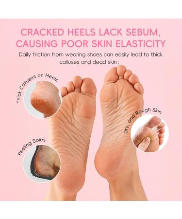 Stick for Cracked Heels - Moisturizing Balm for Dry Feet | 40g Moisturizing Lotion Cream to Soften Skin Reduce Dead Skin Foot Care for Women on the Go - Buy Online on GoSupps.com