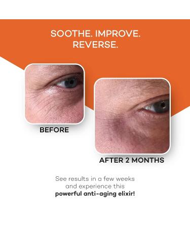 Zocufill Elixir Eye Gel and Face Serum - Eye Bags Treatment for Women and Men - Reduce Dark Circles, Puffy Eyes, and Wrinkles - Buy Online on GoSupps.com