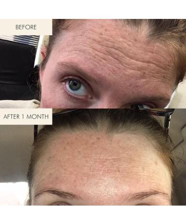 MARA - Algae Enzyme Cleansing Oil + Algae Retinol Face Oil VALUE Bundle | Clean Non-Toxic Plant-Based Skin Care - Buy Online on GoSupps.com