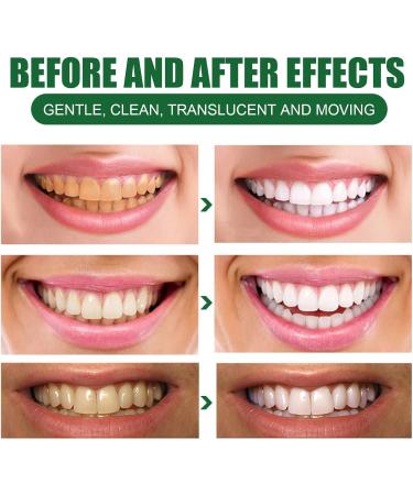 KLYso Premium Teeth Whitening Toothpaste - Remove Stains Freshen Breath Deep Clean & Strengthen Teeth - Anti-Tartar Formula for Oral Hygiene(3PCS) - Buy Online on GoSupps.com