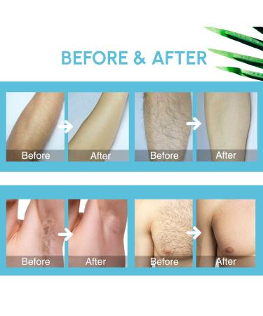 Natural Hair Removal Spray Foam - Effective & Painless Depilatory Cream for Body & Intimate Areas - Women & Men Blue - Buy Online on GoSupps.com