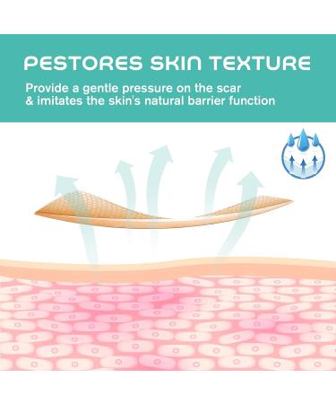 Medical Grade Soft Silicone Tape for Scar Removal - 1 Roll (180cm) - Effective Keloid Treatment & Easy Tear Scar Sheets | Best Scar Treatment for Fast Healing - Buy Online on GoSupps.com