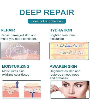 Proregen Scar Removal Spray - Medical Grade Scar Remover for Old and New Scars | Advanced Formula for All Types of Scars - 1pcs - Buy Online on GoSupps.com