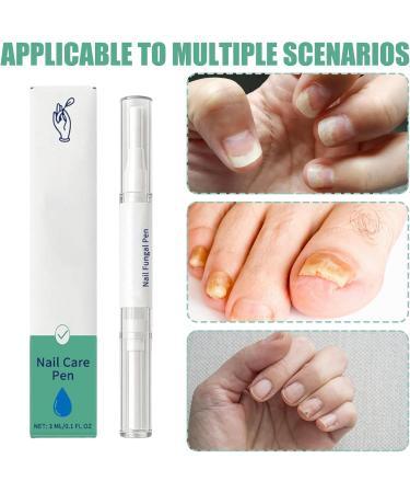 Toenail repair pen 3ml extra strength natural ingrown nail repair solution for cleaning repairing ingrown damaged cracked men women adults - Buy Online on GoSupps.com