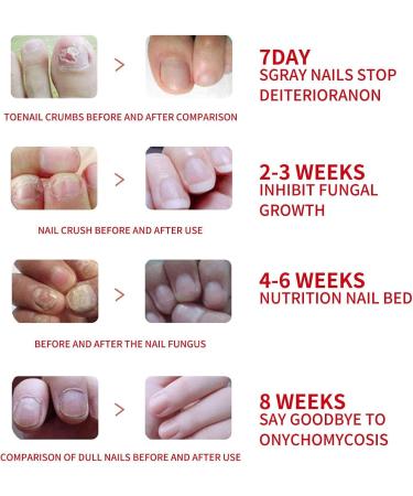 Cuticle and Nail Oil Nail Repair for Growth - Gentle Nail Cuticle Oil Nail Hardener Nail Growth Polish for Adults Teksome - Buy Online on GoSupps.com