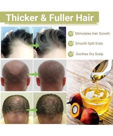 Huile de croissance des cheveux Lifewitqueenp Queenp Ayurvedic Hair Growth Huile l ger pour tous les types de cheveux 1Pcs - Buy Online on GoSupps.com