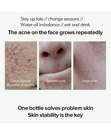 Acne Repair Face Serum Firming Serum For Face Green Tea Hyaluronic Acid Serum Relieve Redness & Acne Natural Face Serum For Acne Day & Night Serum For Face Hydrating Face Oils And Serums-Repair - Buy Online on GoSupps.com