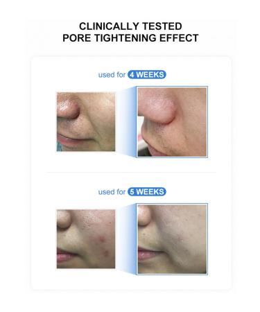 Buy Medicube Zero Pore Serum 27ml - Best Pore-Minimizing Serum | International Shipping Available - Buy Online on GoSupps.com