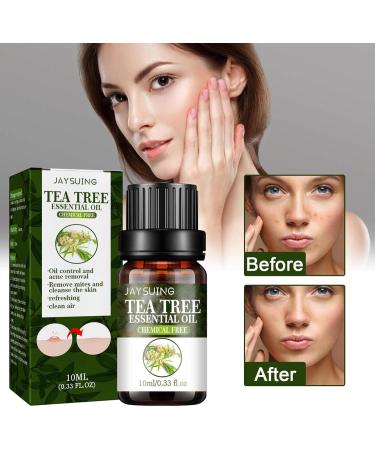 Eteslot 100% Pure Tea Tree Oil Natural Essential Oil for Skin Cell Activation Pore Shrinkage Aromatherapy & Diffuser - 10ml - Buy Online on GoSupps.com